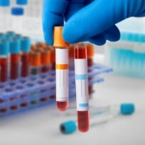 HEMATOLOGY